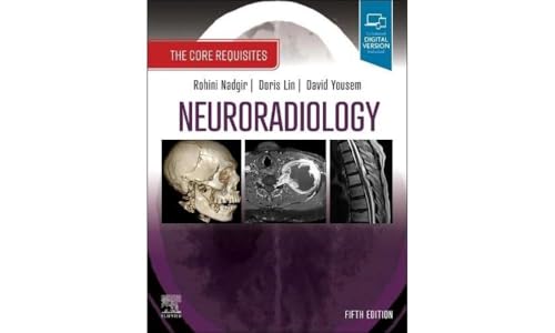 Neuroradiology : The Core Requisites